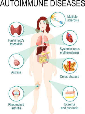 list of autoimmune diseases